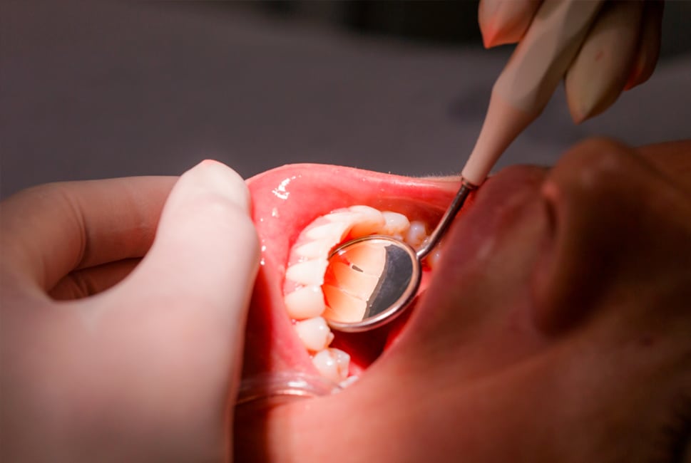 The Impact of Orthodontics on Oral Health